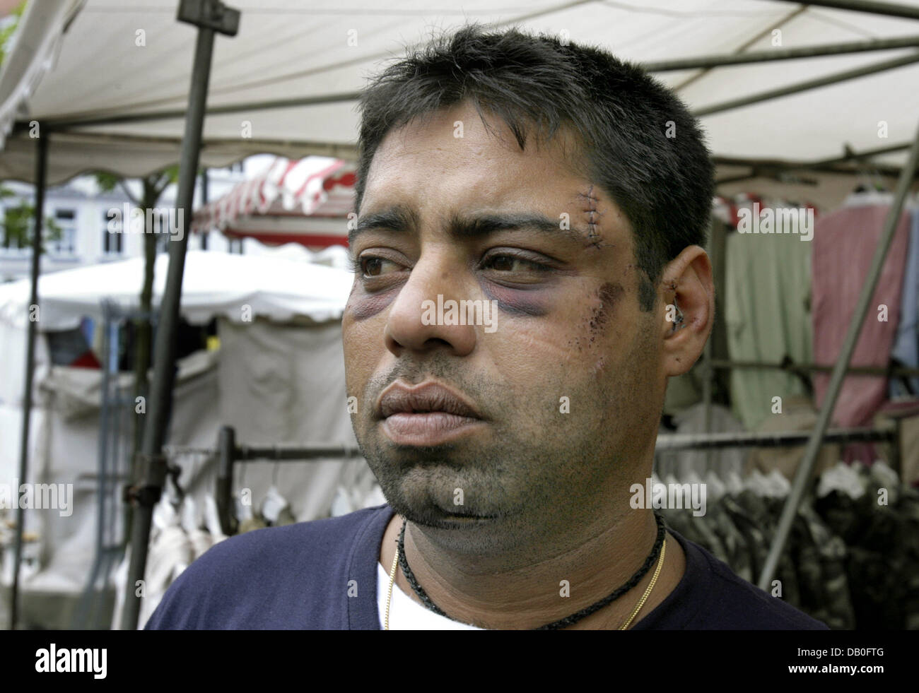 Singh Gurminder, one of eight vicitims of a chivy on Indian visitors of a town festivity, pose at a friend's booth of a weekly market in Doebeln, Germany, 22 August 2007. Around 50 young Germans chased and injured eight Indians after an argument in Muegeln sunday night (19 August). Photo: Waltraud Grubitzsch Stock Photo