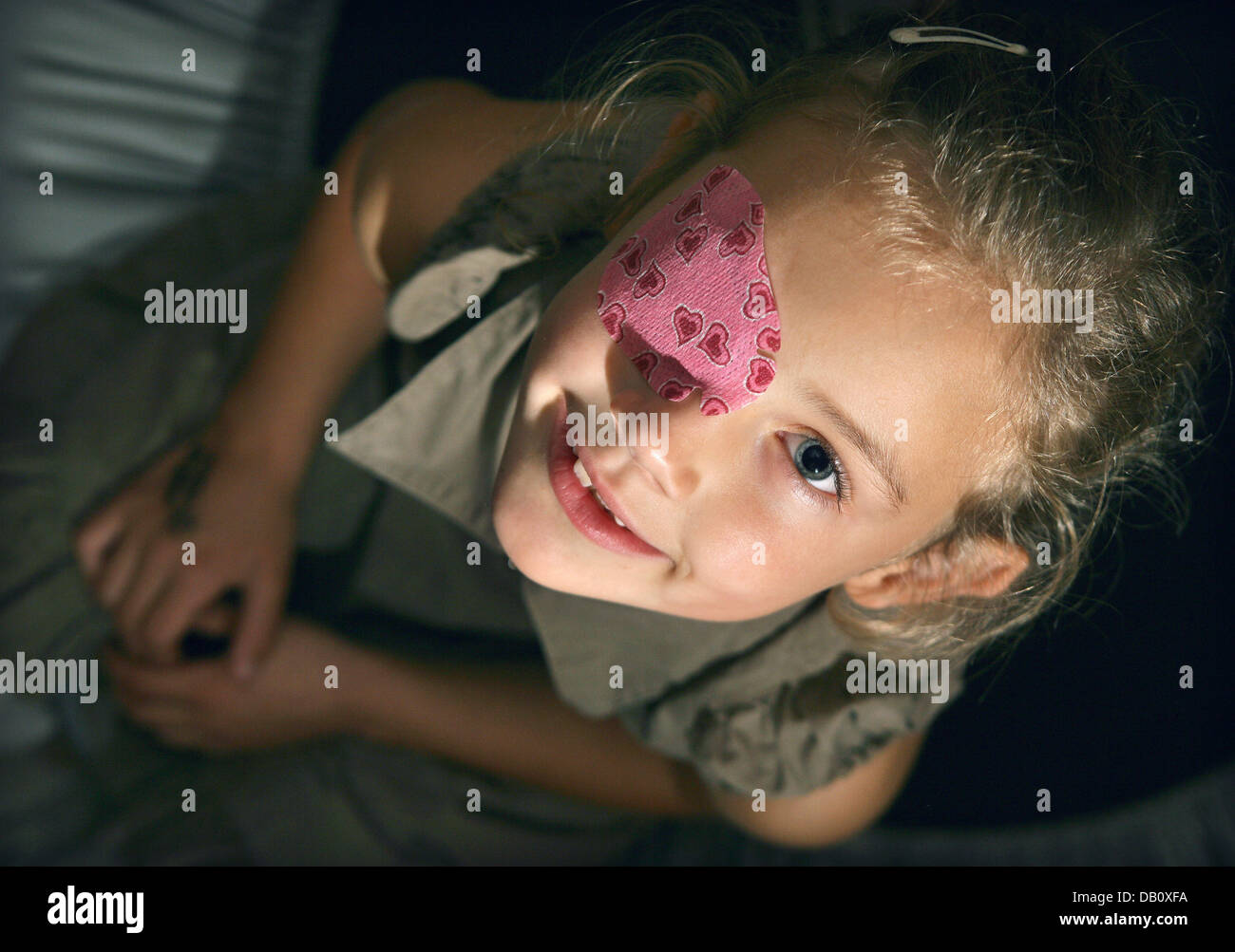 A little girl suffering from Strabismus wears an eye patch to correct