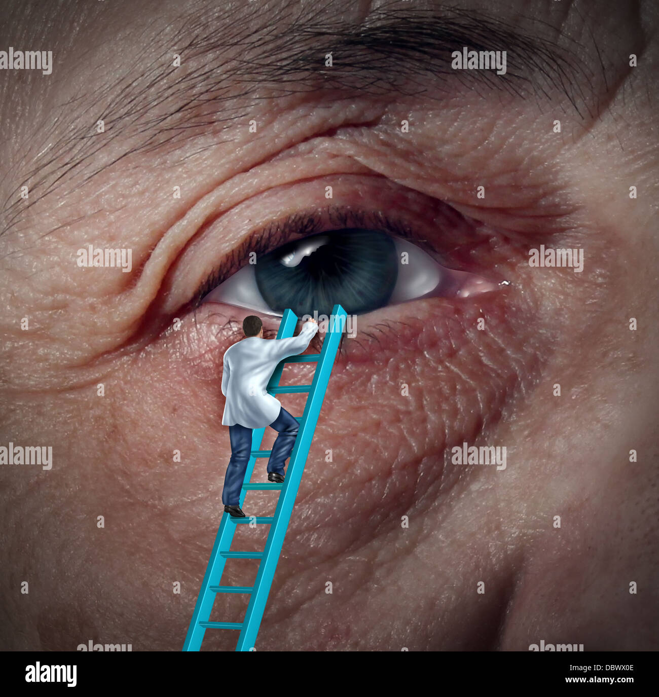 Medical Eye Care concept with an ophthalmologist or optometrist climbing a ladder to givie a diagnosis on an aging elderly patient that may have vision problems due to cataracts or other ocular diseases. Stock Photo