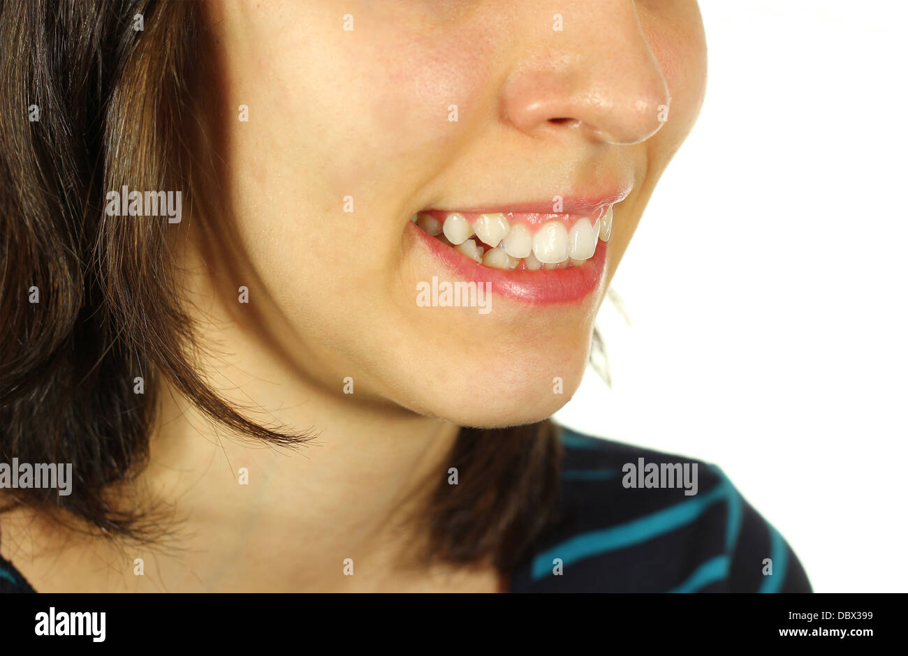 Girl crooked teeth smiling hi-res stock photography and images - Alamy