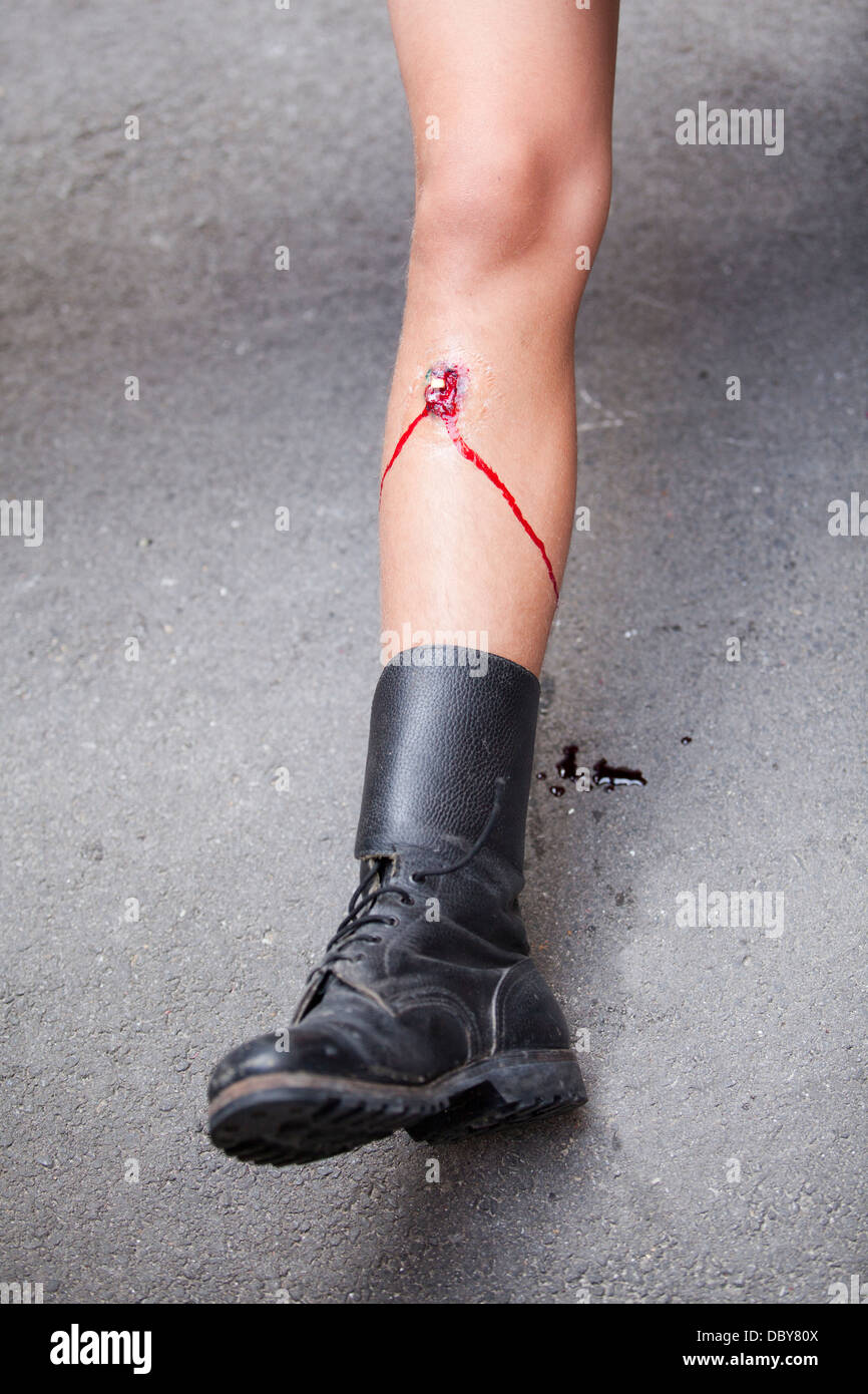 gunshot wound on soldier's leg Stock Photo