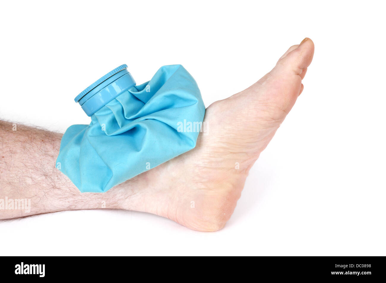 Sprained ankle hires stock photography and images Alamy