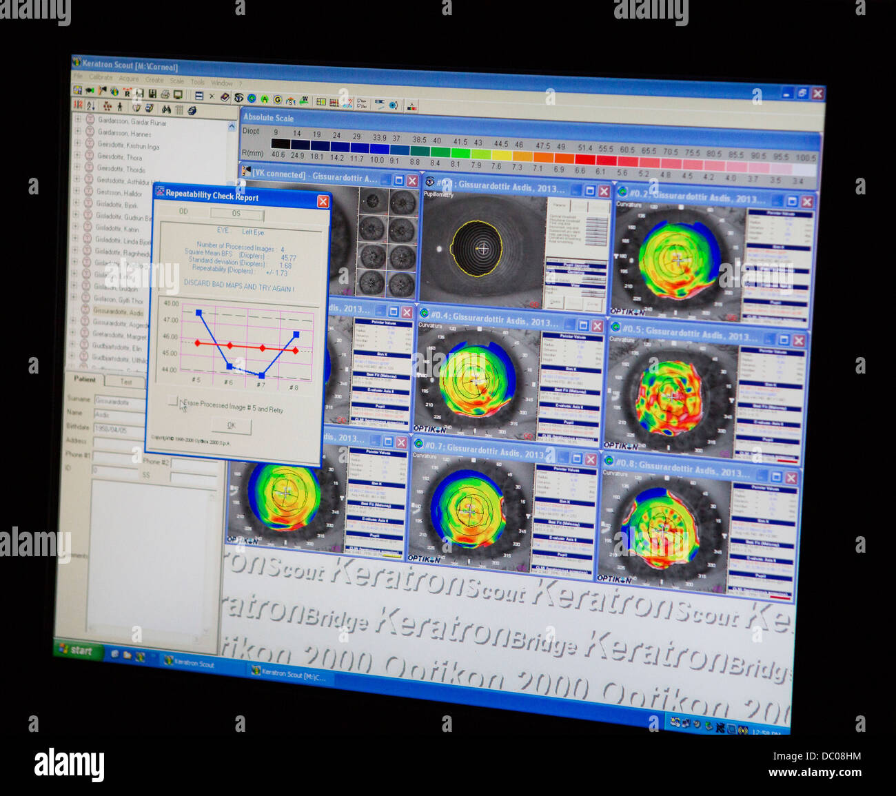 Computer Used During Laser Lasik Eye Surgery Stock Photo Alamy