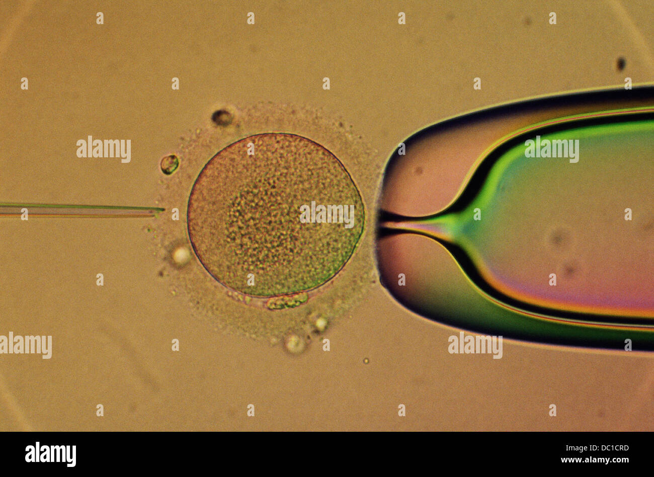 Micro injection. Testtube fertilization Stock Photo Alamy
