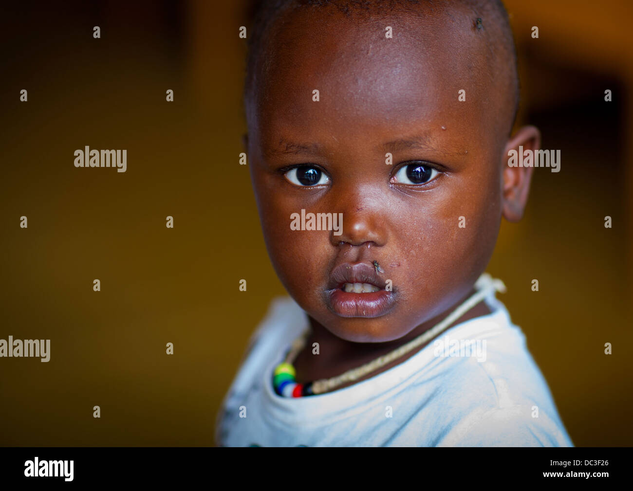 Mingi Baby Rescued In Omochild Foundation, Jinka, Omo Valley, Ethiopia