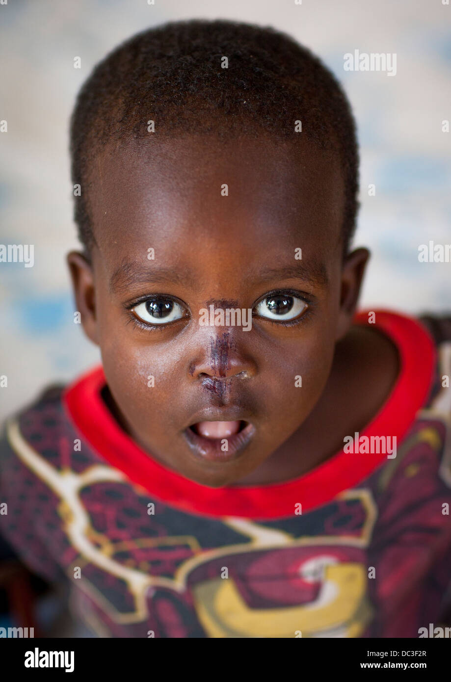 Mingi Baby Rescued In Omochild Foundation, Jinka, Omo Valley, Ethiopia