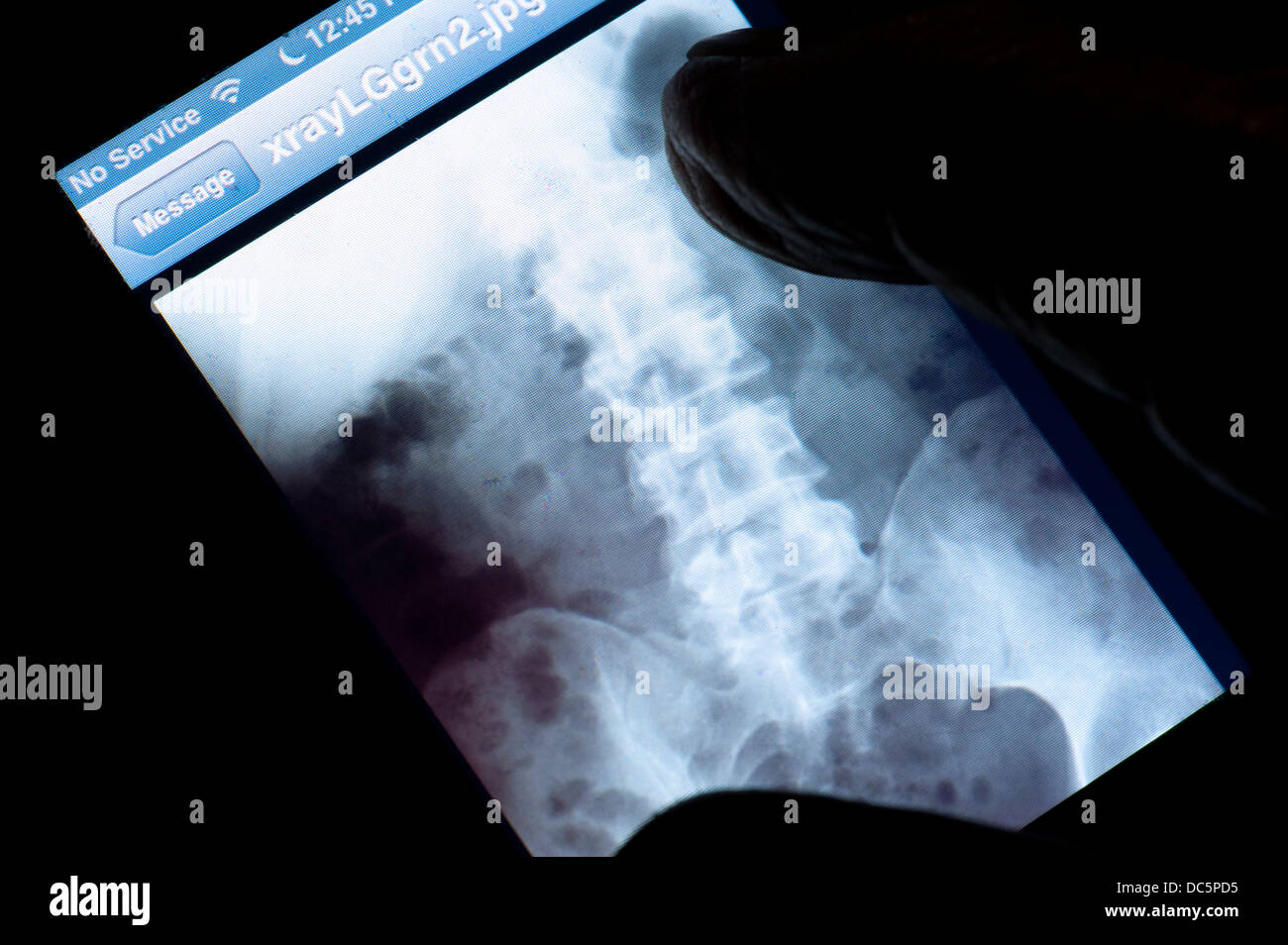 iPhone with closeup X-ray image Stock Photo