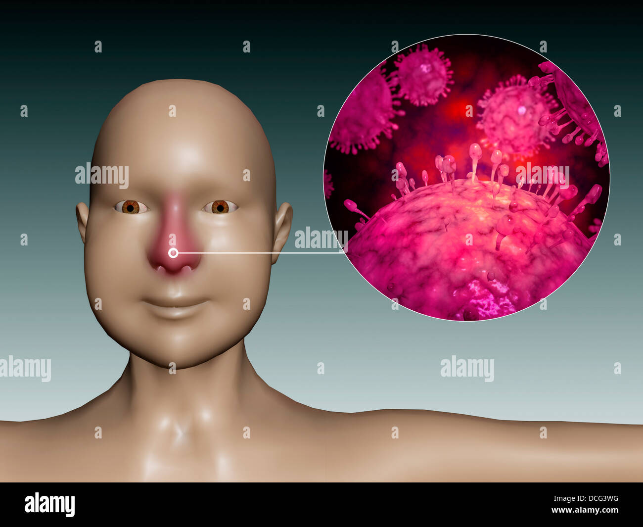 Common cold influenza virus with microscopic close-up. Stock Photo