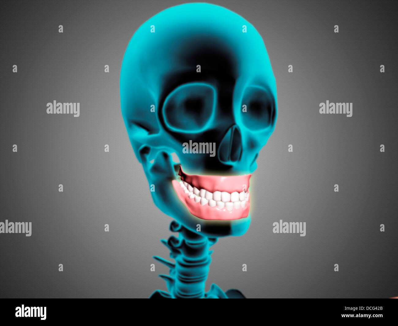 X-ray view of human skeleton showing teeth and gums. Stock Photo