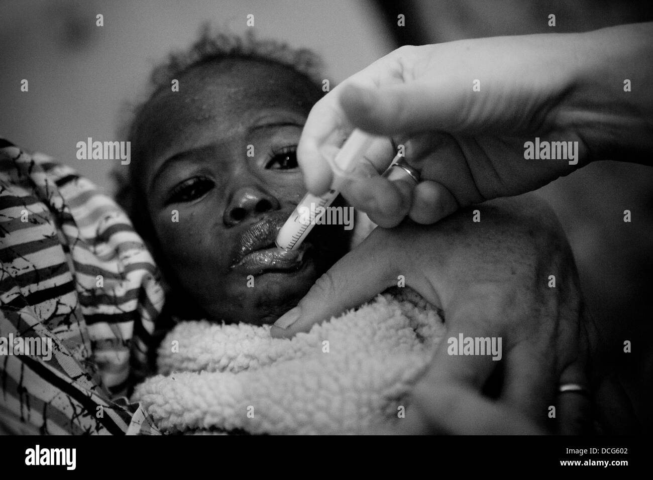 HIV positive child is treated at an orphanage in Moshi, Tanzania. Stock Photo