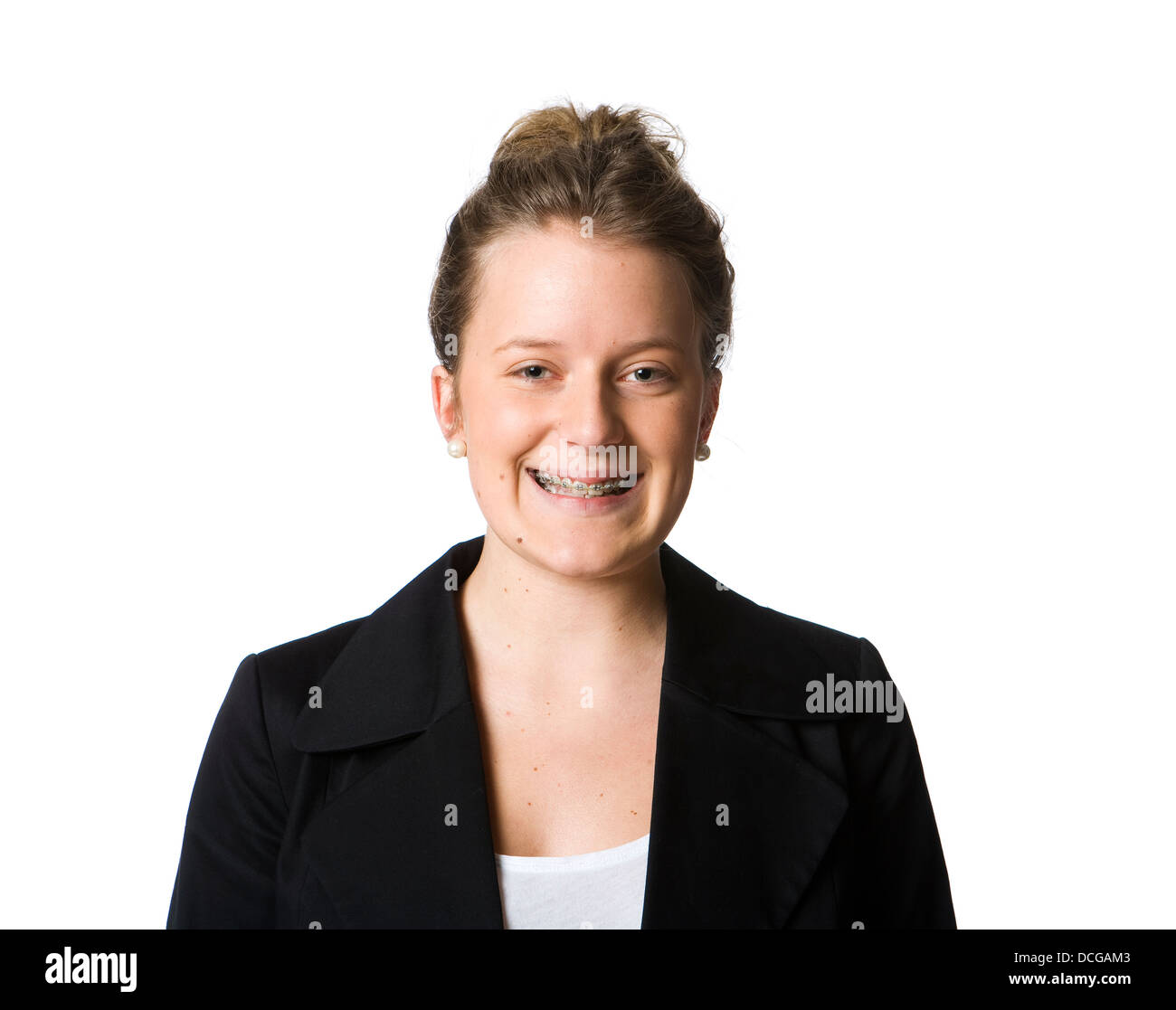 Smiling girl with a bridge in her mouth Stock Photo Alamy