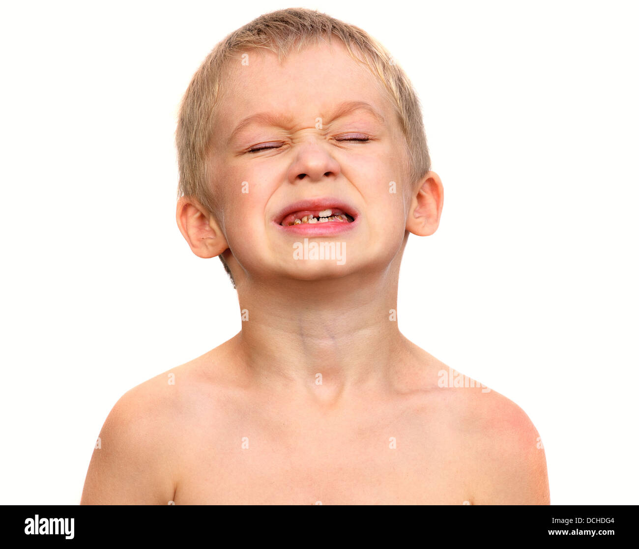 Little Boy Child making sore crying Face showing Calf's Teeth Decay