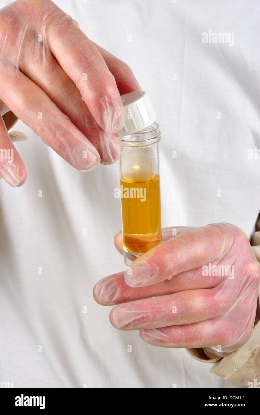 some human urine in a sample bottle Stock Photo Alamy