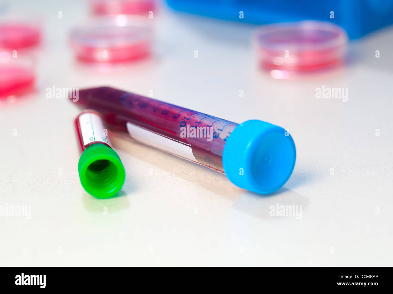 Blood In tube for laboratory analysis Stock Photo Alamy