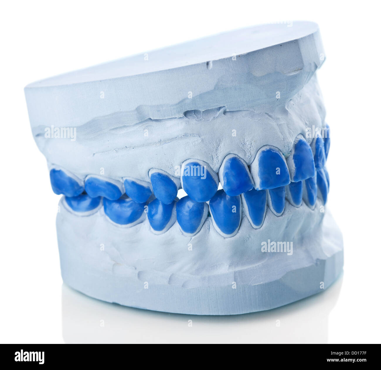 individual plaster dental molds to make trays Stock Photo