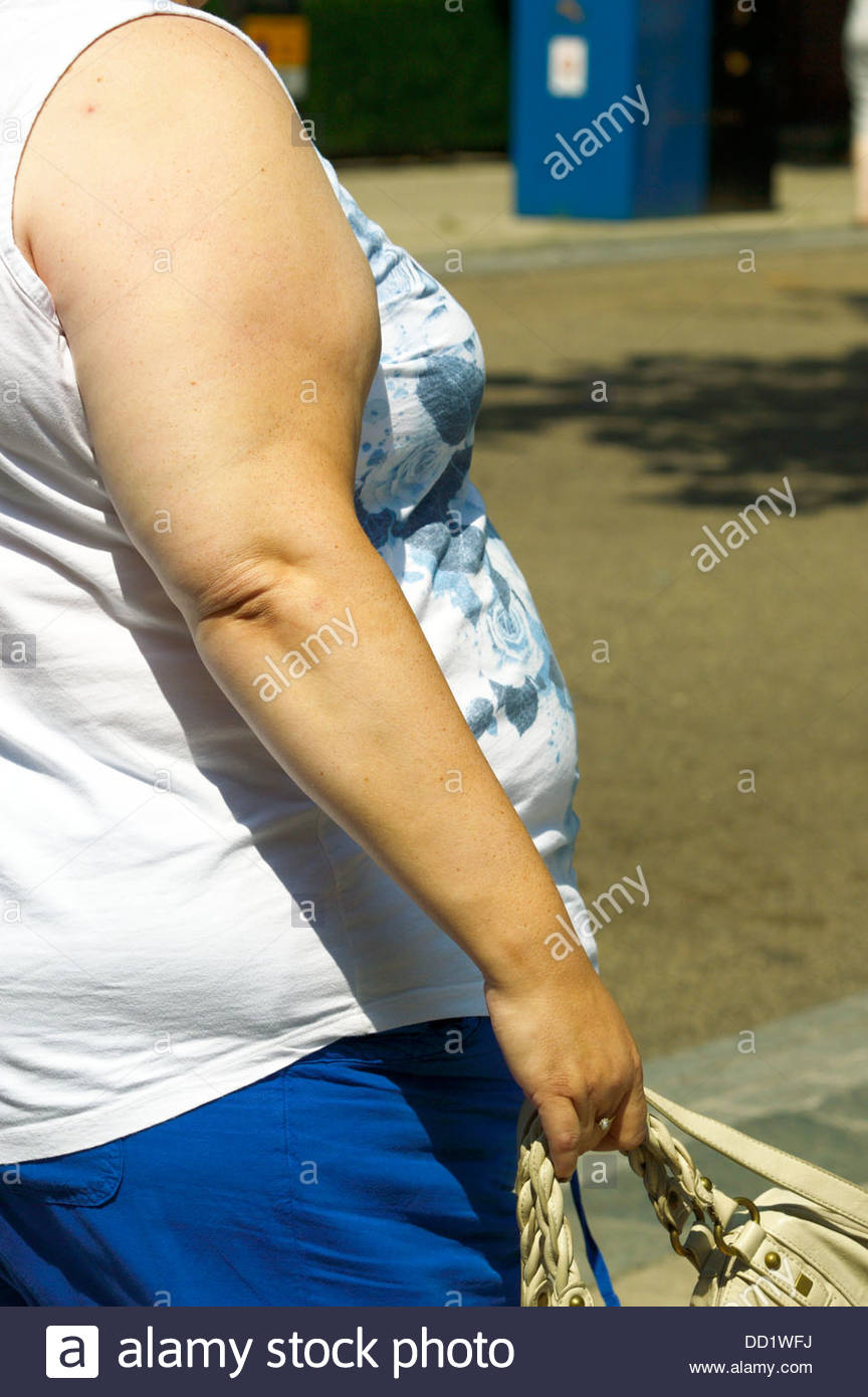 Obese Fat Female Walking Stock Photos & Obese Fat Female Walking Stock
