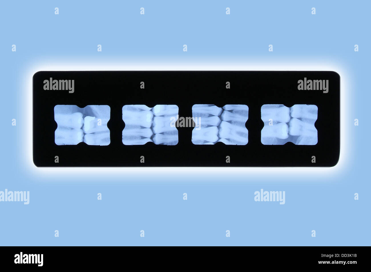 Dental xray sheets glowing on a blue background Stock Photo Alamy