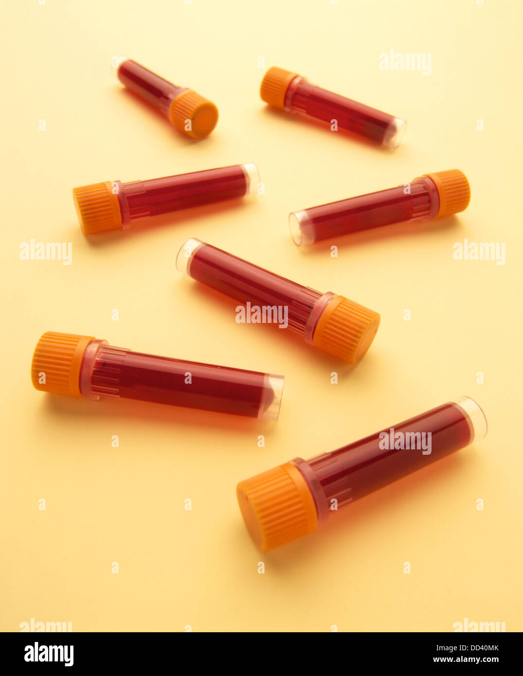 Blood group test hires stock photography and images Alamy
