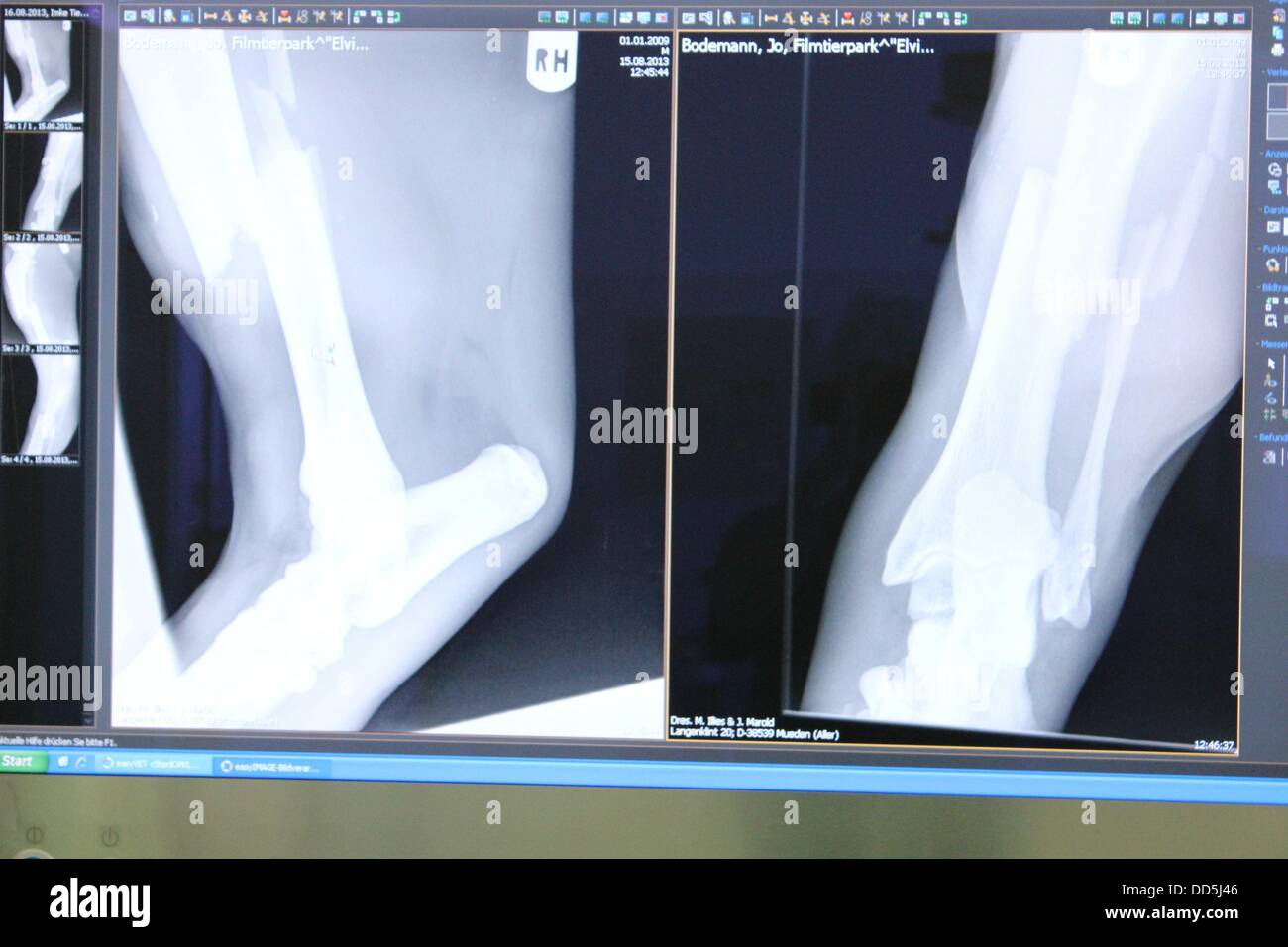 HANDOUT - A handout photo by the movie animal park Eschede dated August 2013 shows the X-ray image of the fracture in the leg of the White Tiger Elvis at the University HANDOUT - A handout photo by the movie animal park Eschede dated August 2013 shows the X-ray image of the fracture in the leg of the White Tiger Elvis at the University