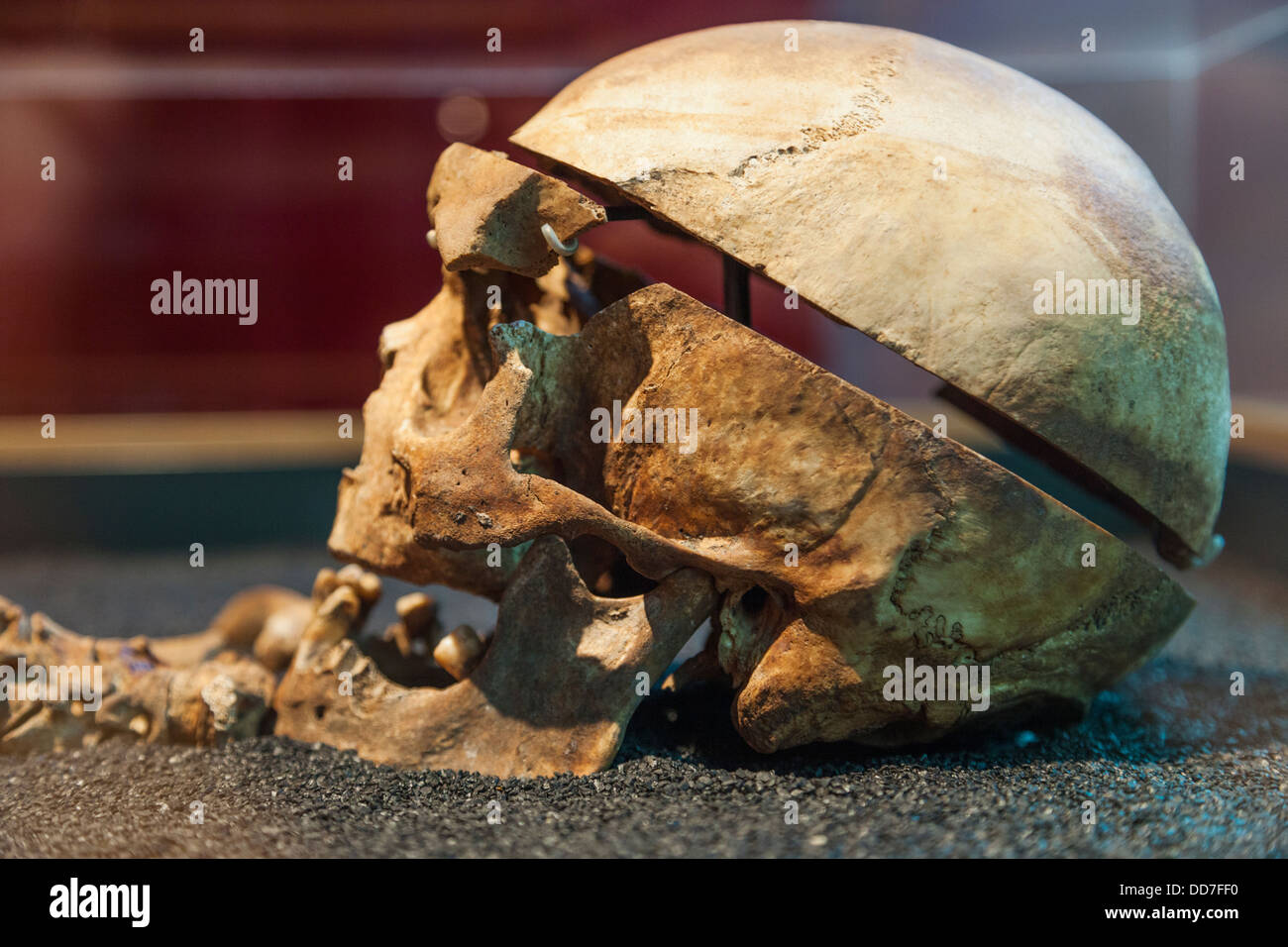 England, London, Dissected Skull from The Royal London Hospital Cemetery Stock Photo
