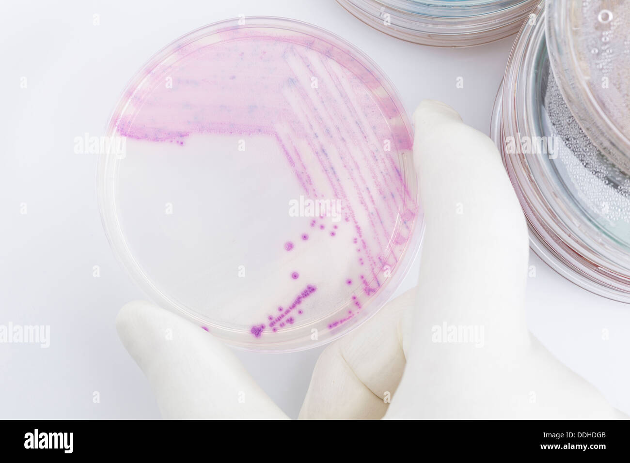 Human hand holding petri dish with bacteria, close up Stock Photo