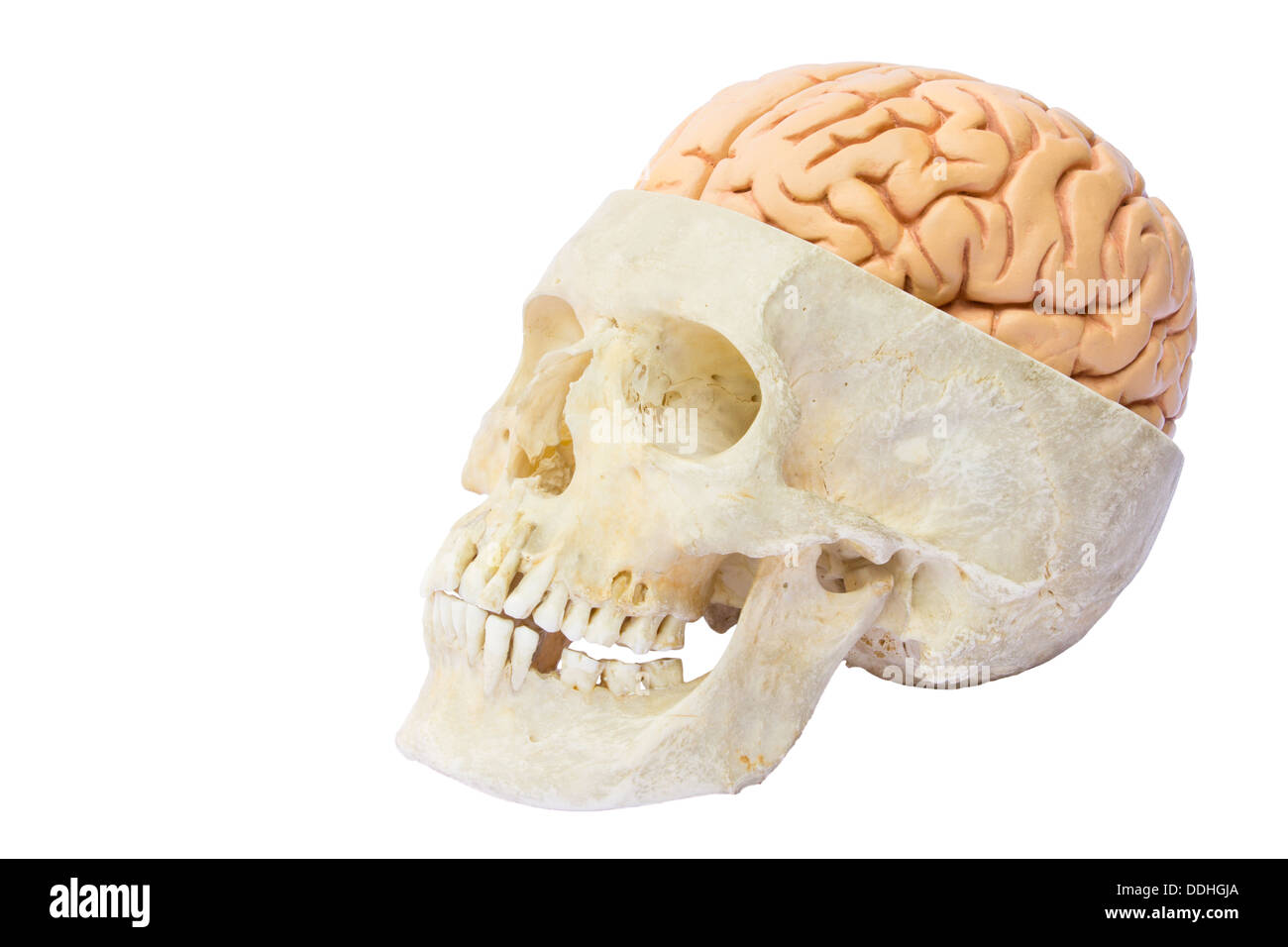 Human skull with artificial brains Stock Photo