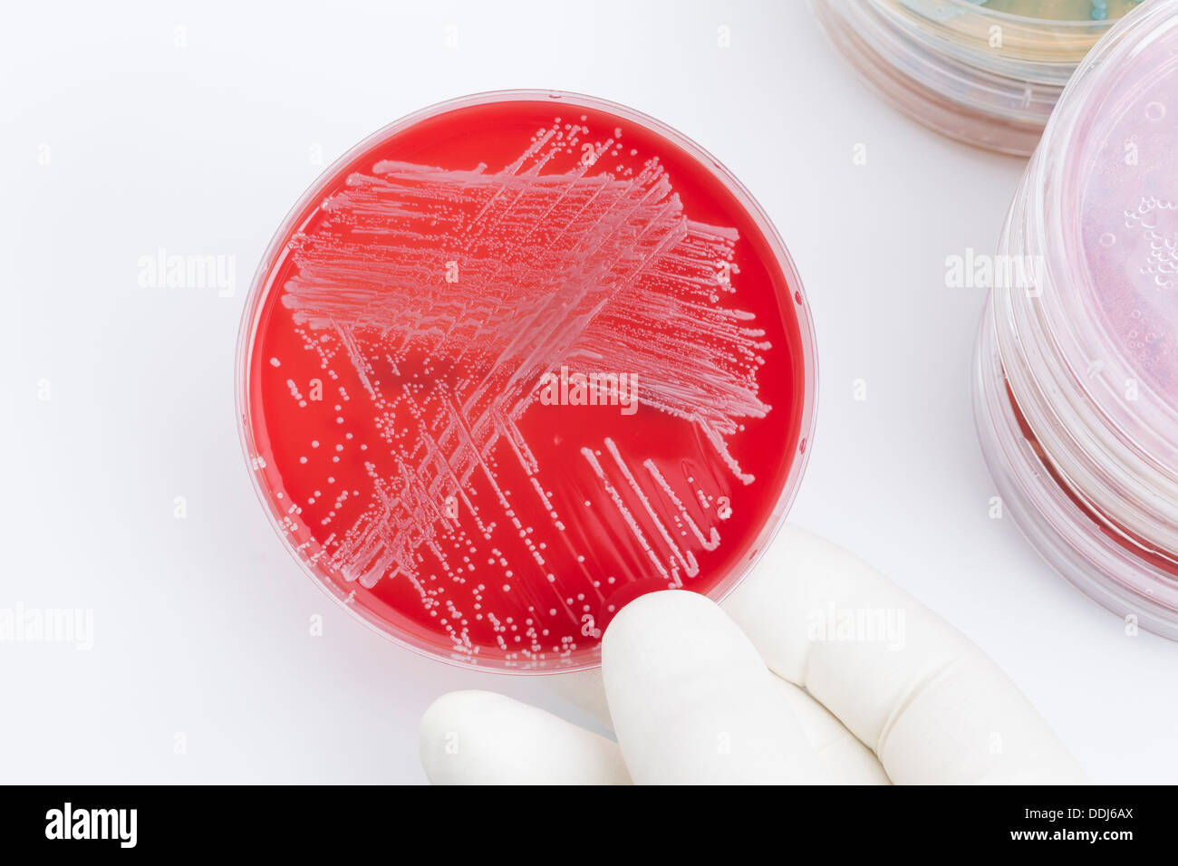 Human hand holding petri dish with bacteria, close up Stock Photo Alamy