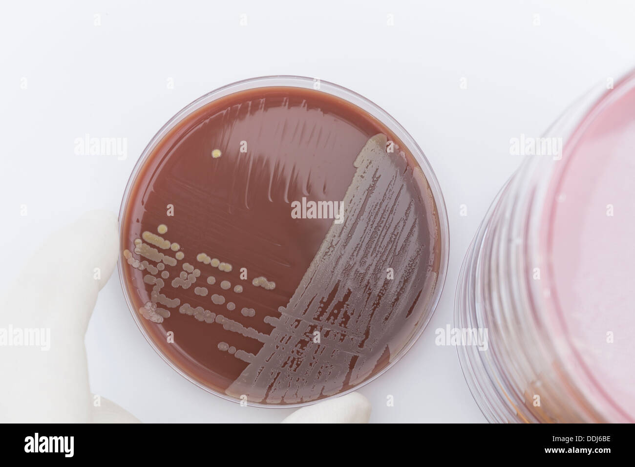 Human hand holding petri dish with bacteria, close up Stock Photo