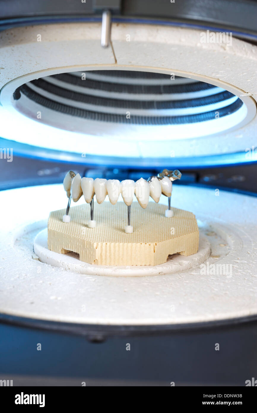 Ceramic bridge in furnace for dental Stock Photo Alamy