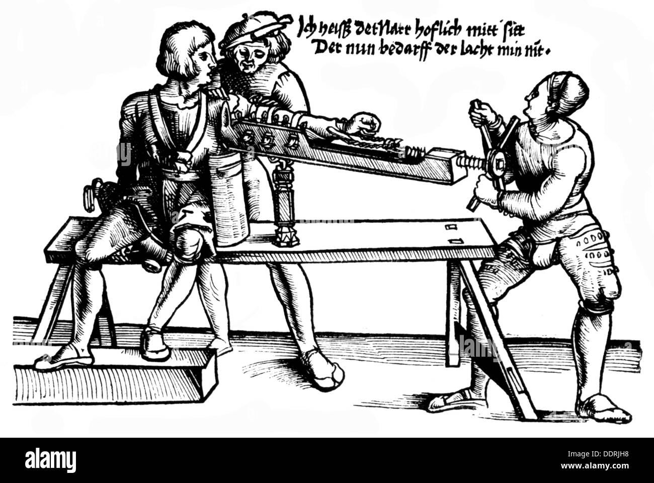 medicine, surgery, arms and legs, treatment of a war wound by a doctor's assistant, woodcut, out of: Hans von Gersdorff (circa 1455 - 1529), 'Feldbuch der Wundarzney', print: J.Schott, Strasbourg, 1528, Additional-Rights-Clearences-Not Available Stock Photo