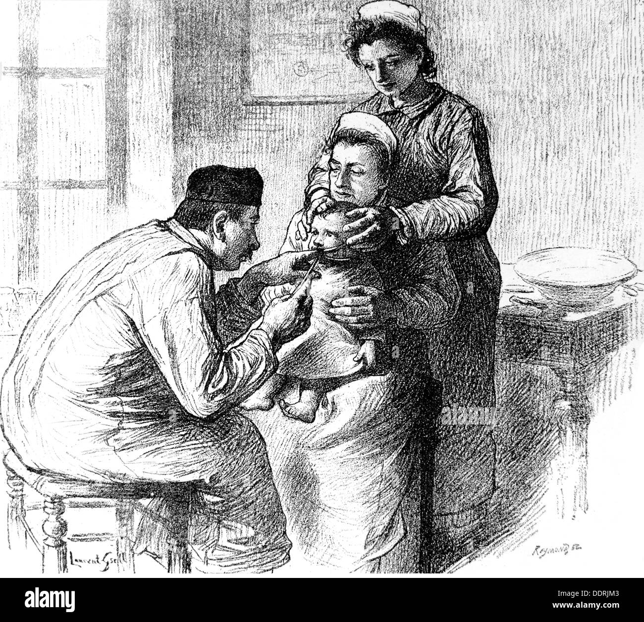 medicine,diseases,diphtheria,resident doctor intubating child with diphtheria,after drawing by Lucien Laurent-Gsell(1860 - 1944),wood engraving by Reymond,late 19th century,19th century,graphic,graphics,half length,medical doctor,medic,medics,doc,doctors,docs,physician,physicians,sitting,sit,treatment,treatments,treat,treating,doctor,doctoring,intubation,inserting a tube,intubate,nurse,nurses,sister,sisters,holding,hold,patient,patients,sick,diseased,ill,infectious disease,communicable disease,communicable diseases,r,Additional-Rights-Clearences-Not Available Stock Photo