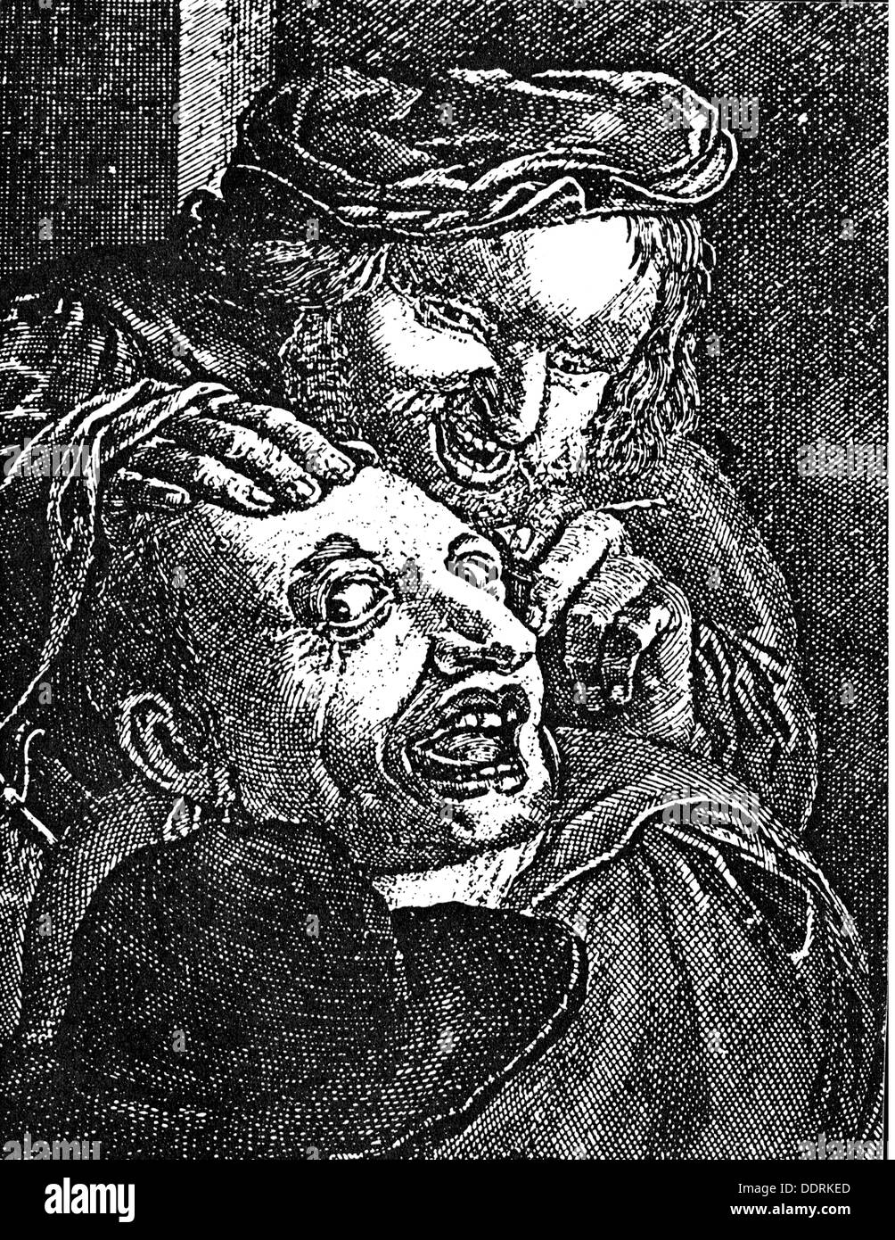 medicine, operation, brain and neurosurgery, head surgery by a barber surgeon, copper engraving, 17th century, 17th century, graphic, graphics, undergo surgery, need surgery, brain, brains, brain surgery, head, heads, cranium, treatment, treatments, treat, treating, doctor, doctoring, operating, operate, knife, knives, cutting, cut, cuts, headpiece, headpieces, beret, berets, half length, barber surgeon, medicine, medicines, operation, operations, historic, historical, man, men, male, people, Artist's Copyright has not to be cleared Stock Photo