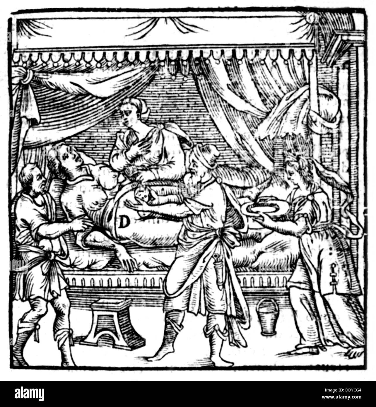 medicine, birth / gynecology, childbearing by means of Caesarean, woodcut, out of: Scipione Mercurio, 'La Comare o ricoglitrice', Milan, 1618, Additional-Rights-Clearences-Not Available Stock Photo