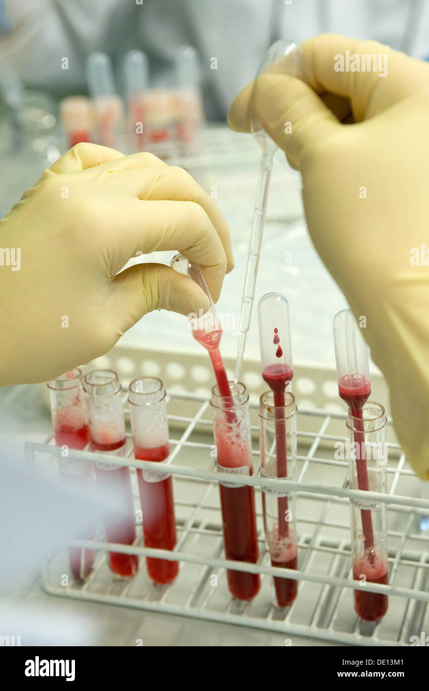 Cytogenetics, preparation of blood samples, Medical Genetics Center MGZ, Laboratory of Human Genetics, Munich, Bavaria Stock Photo