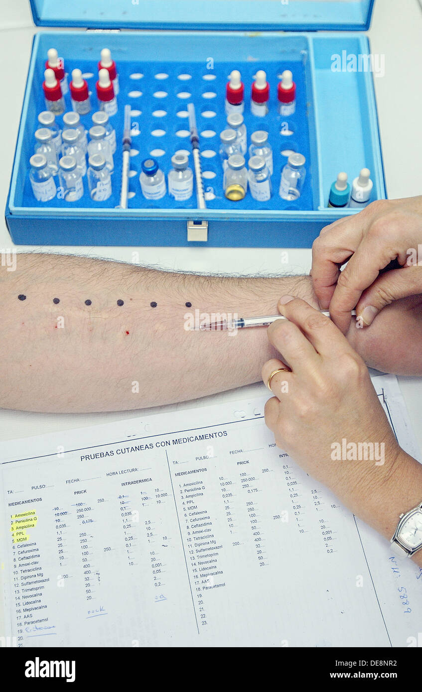 Allergy testing at hospital Stock Photo Alamy