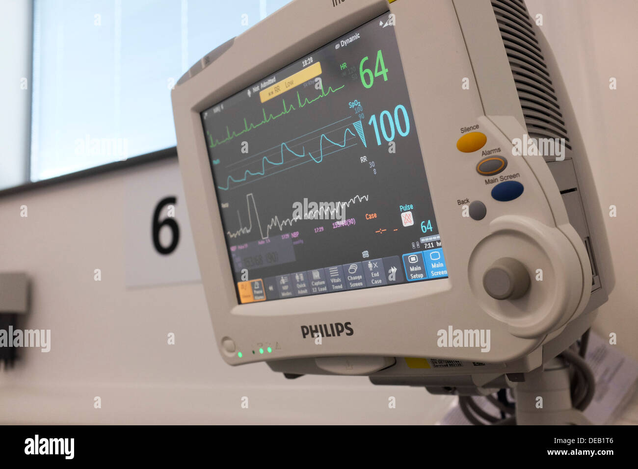 Patient monitoring equipment display at the Accident and Emergency dept, Bronglais Hospital