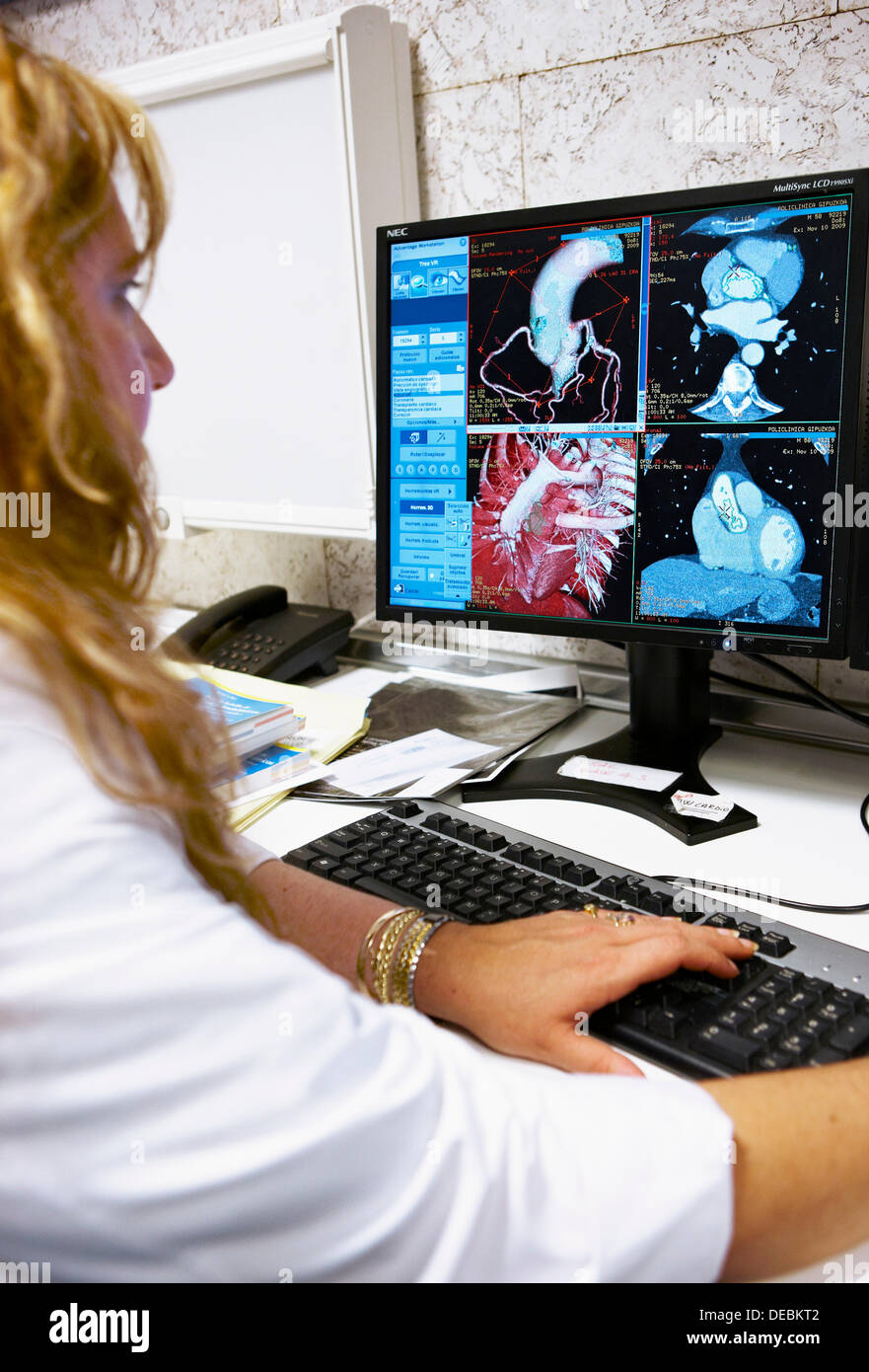 HD(highdefinition) scan of heart, CAT, medical imaging for diagnosis