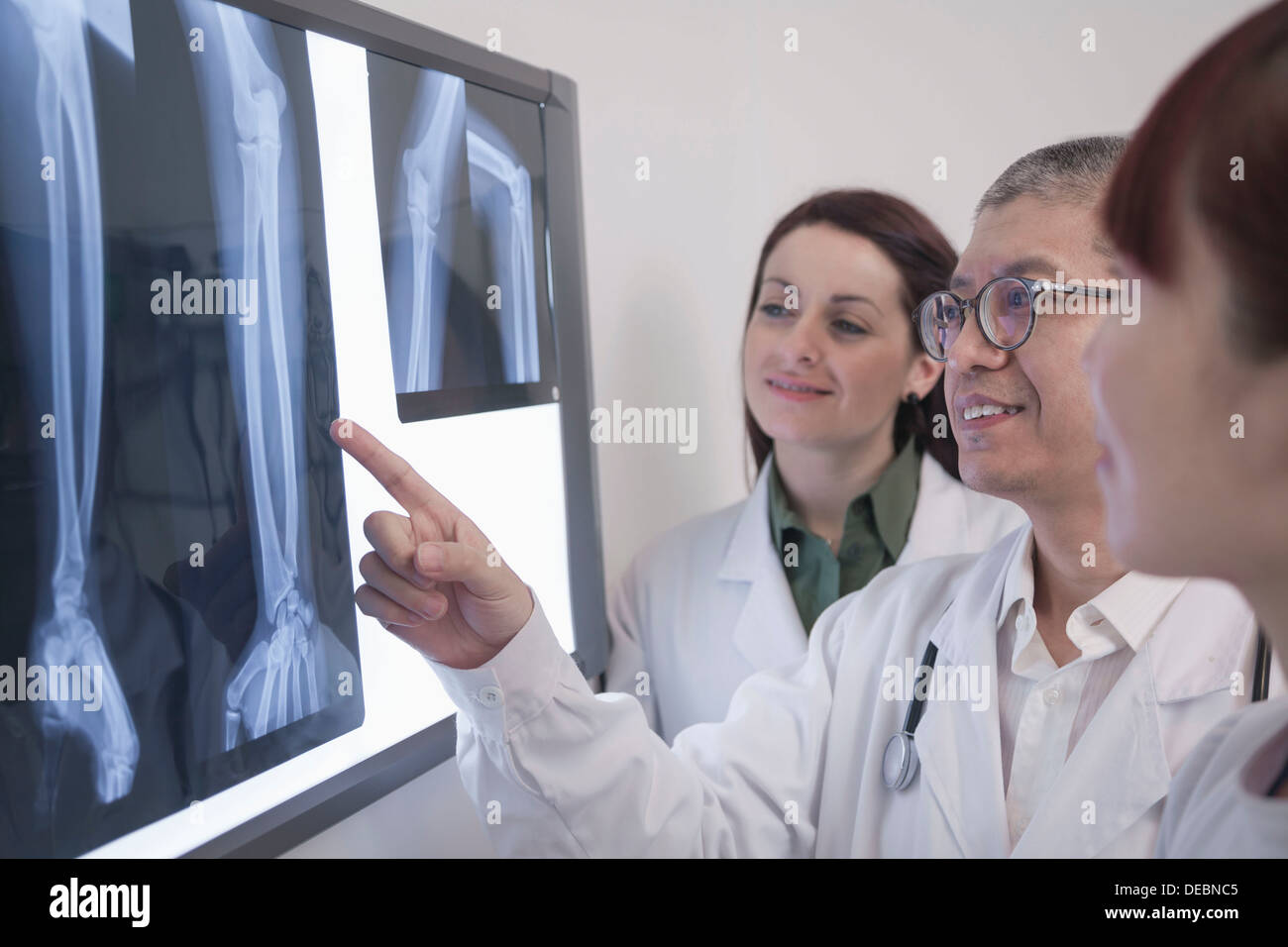 Three smiling doctors looking at xrays of human bones, one doctor is