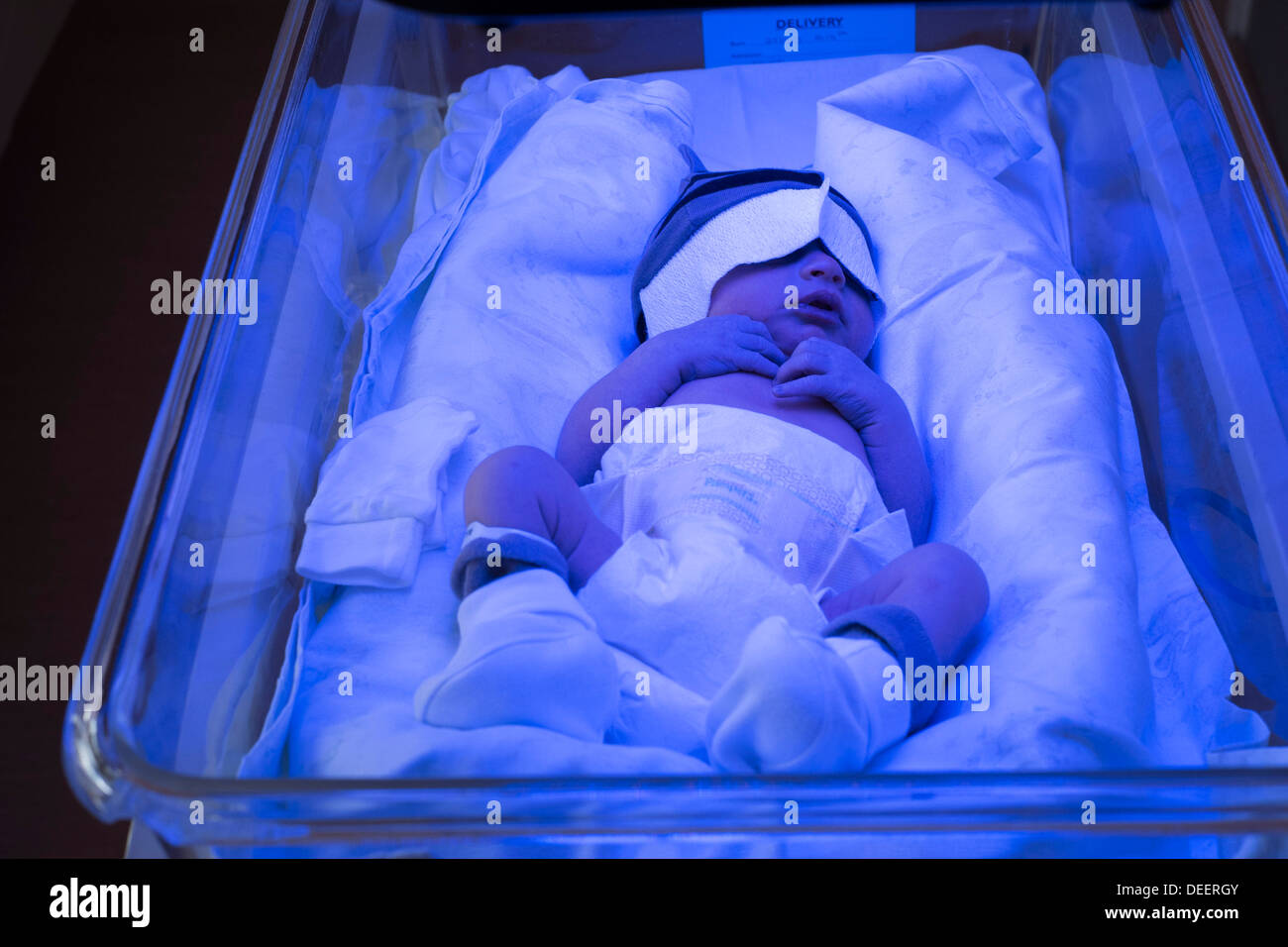 A Newborn Baby Boy Getting Treated For Jaundice Under A Phototherapy