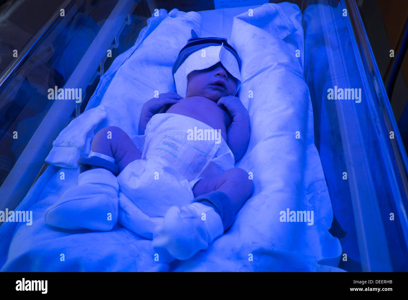 A newborn baby boy getting treated for jaundice under a phototherapy