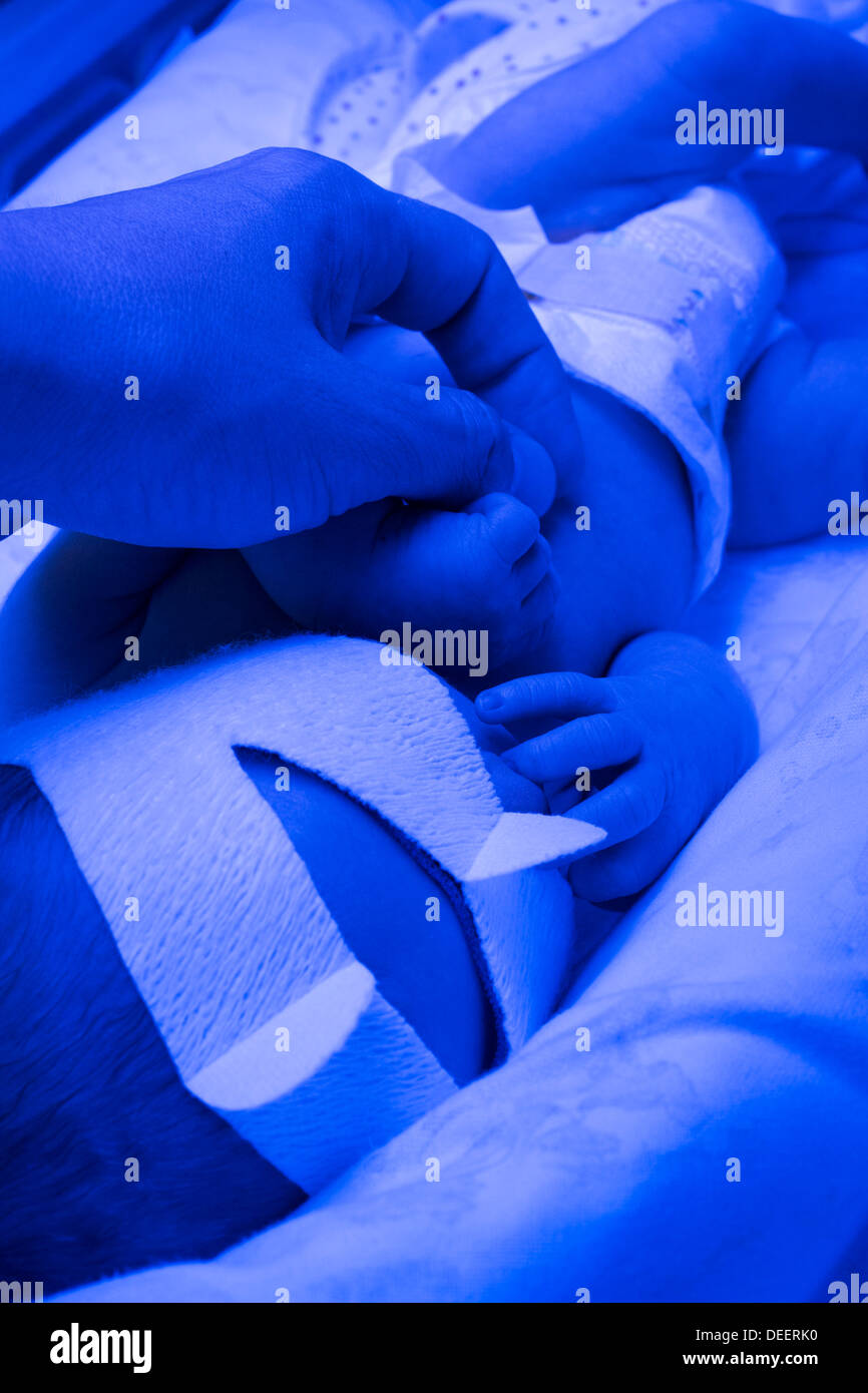 A newborn baby boy getting treated for jaundice under a phototherapy