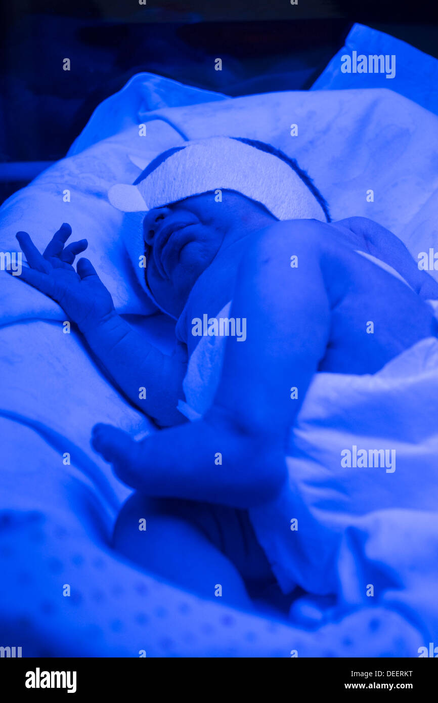 A newborn baby boy getting treated for jaundice under a phototherapy lamp Stock Photo Alamy