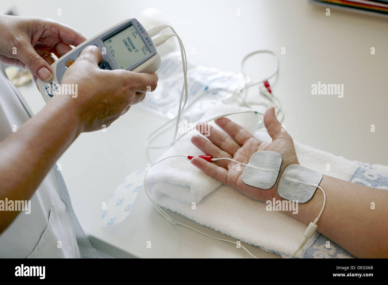 Electrical stimulation hires stock photography and images Alamy