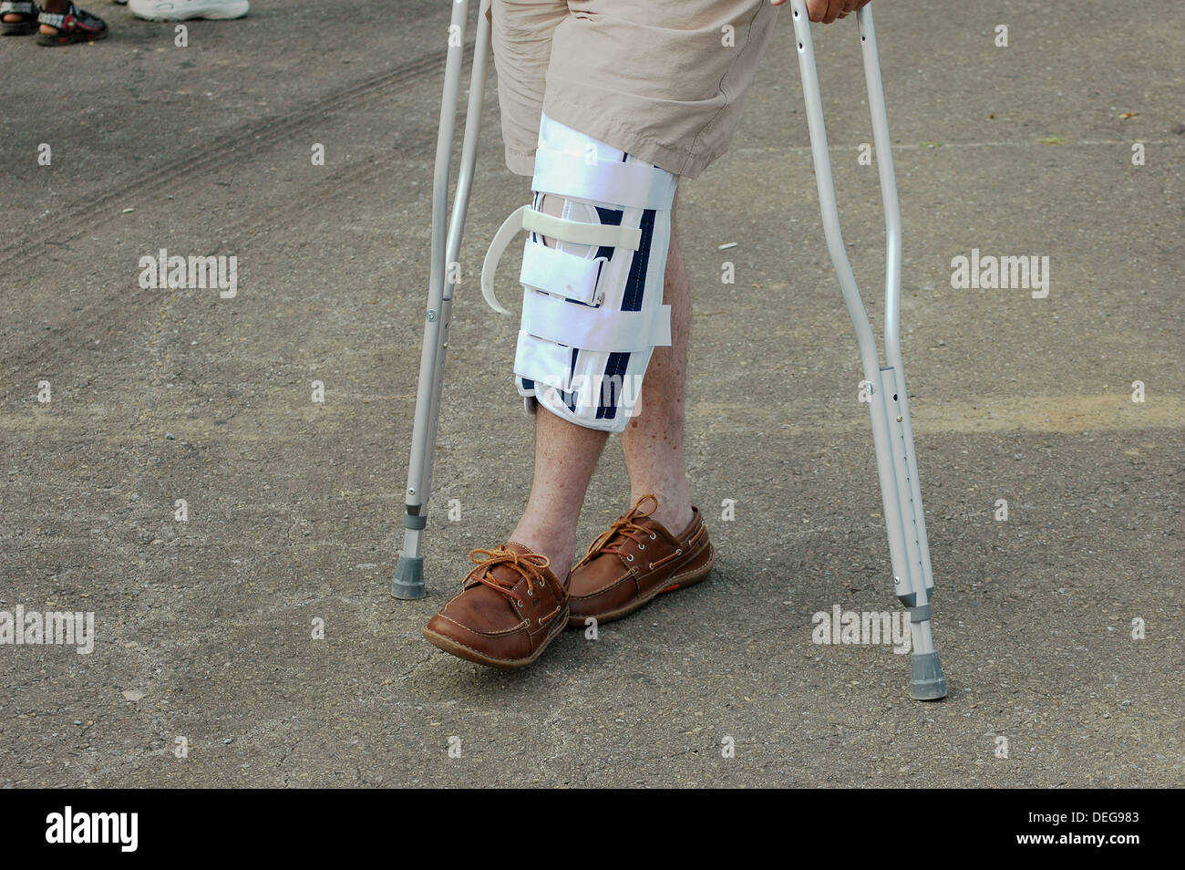 Man On Crutches High Resolution Stock Photography and Images Alamy