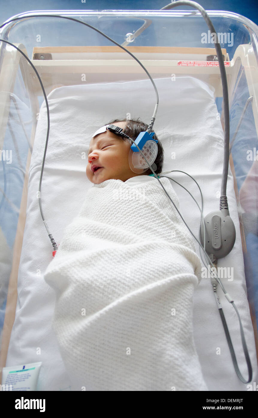Newborn baby hearing screening test Auditory Brainstem Response Stock Photo