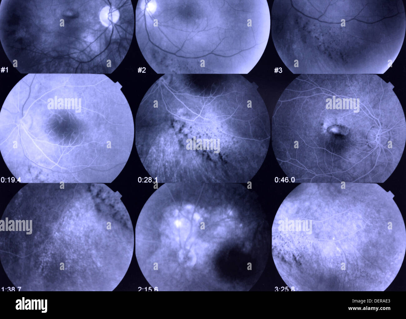 Magnified image of retina of eye Stock Photo