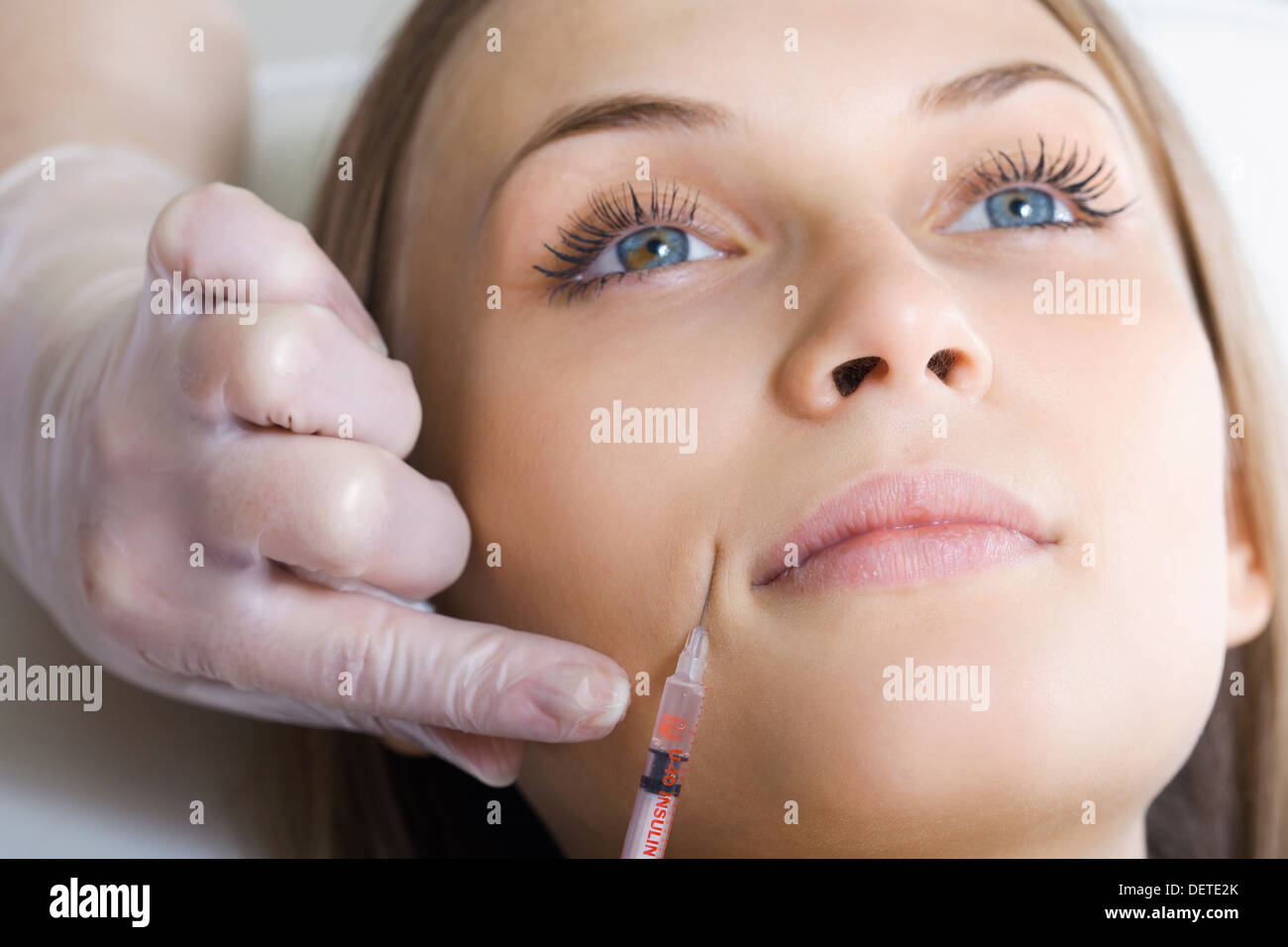 botox or hyaluronic acid injection Stock Photo Alamy