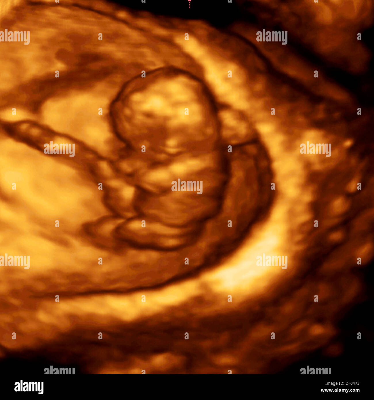 Baby scan 3d hi-res stock photography and images - Alamy