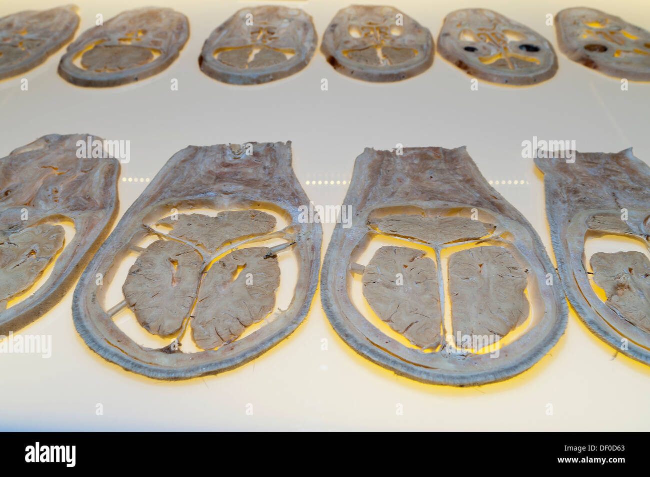 Plastination specimen of human head, transverse sections Stock Photo