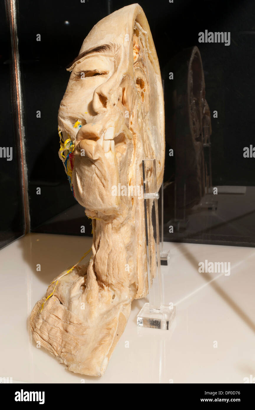 Plastination specimen of section of a human head and neck Stock Photo
